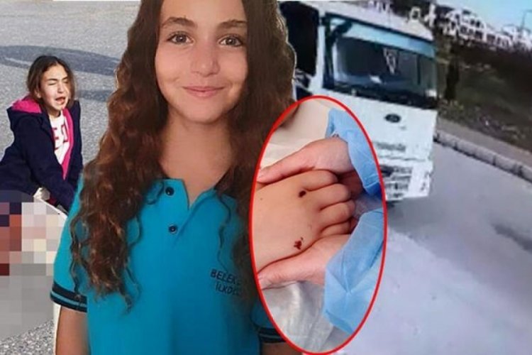 K&ouml;pekten ka&ccedil;arken ezilen Mahra, yaşam savaşını s&uuml;rd&uuml;r&uuml;yor