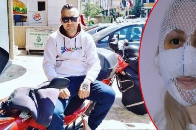 Sultan'a kimyasal madde atan zanlı i&ccedil;in yakalama kararı