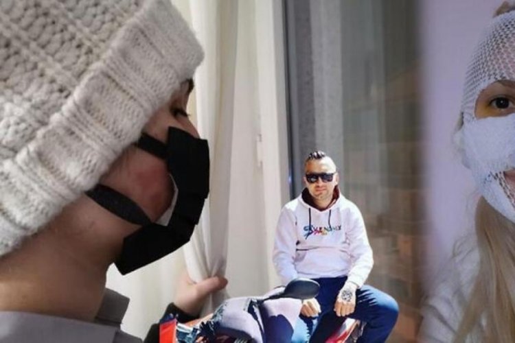 Eski sevgilisinin y&uuml;z&uuml;ne kimyasal madde atan şahıs yakalandı