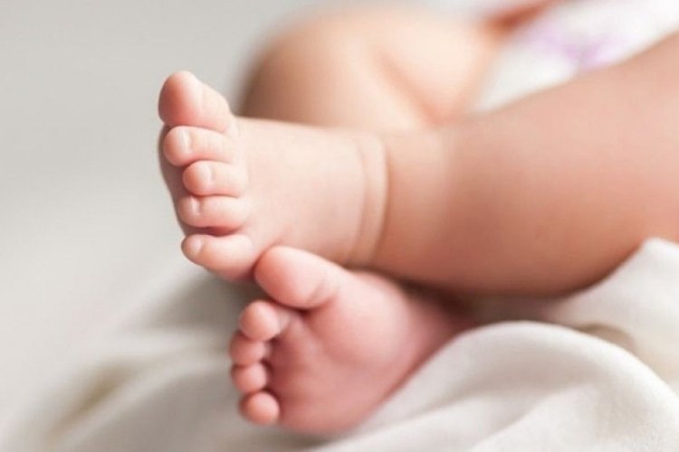 Hindistan'da &ccedil;ift başlı bebek doğdu