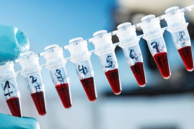 &Uuml;cretsiz SMA taramasına giren &ccedil;iftlerden 10'u riskli &ccedil;ıktı