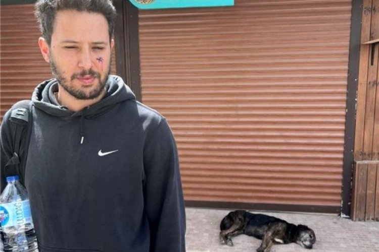 Tuan Tunalı'ya k&ouml;pek saldırdı