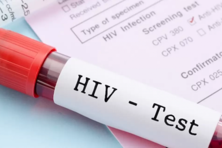Yanlış HIV testine dava