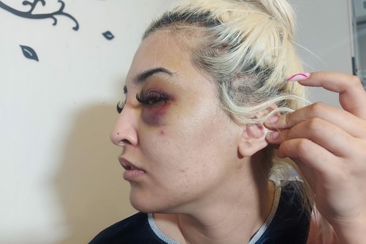 Gamze'nin darpla su&ccedil;ladığı şahsa cinsel saldırıdan su&ccedil; duyurusu