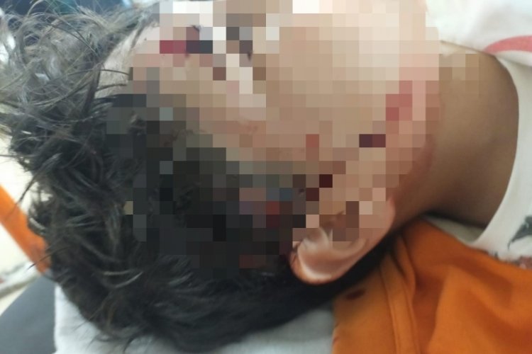 Bursa'da 10 yaşındaki &ccedil;ocuğa başıboş 8 k&ouml;pek saldırdı