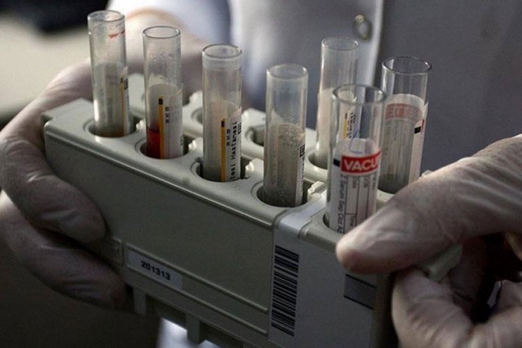 &Ccedil;ocuklarda gizemli hepatit g&ouml;r&uuml;lme oranı arttı