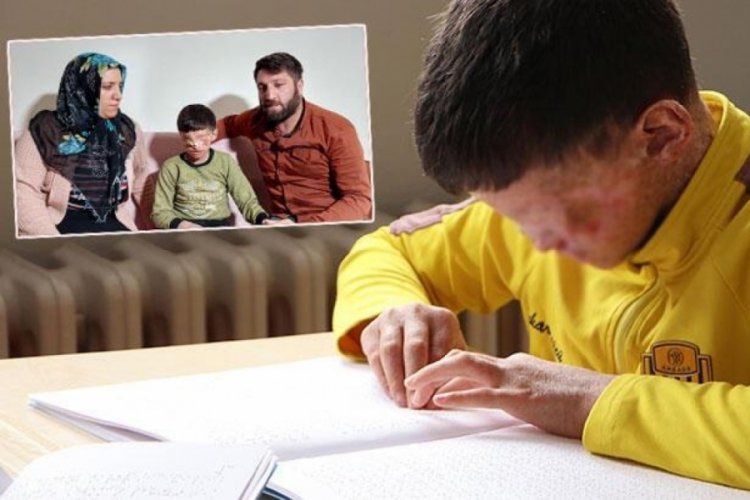 G&ouml;zleri kapanan cilt kanseri Salih: Ailemi merak ediyorum