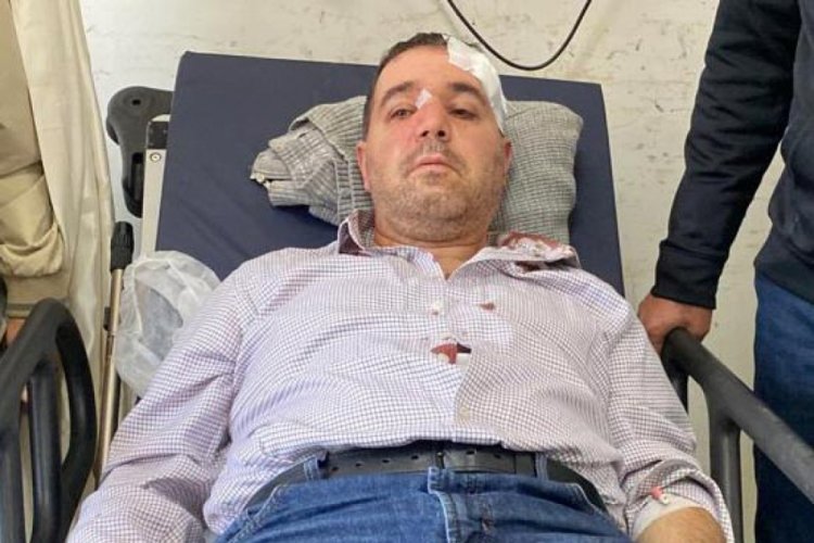 'Beni taciz ediyorsun' diyerek doktorun darbeden şahıs serbest &nbsp;&nbsp;