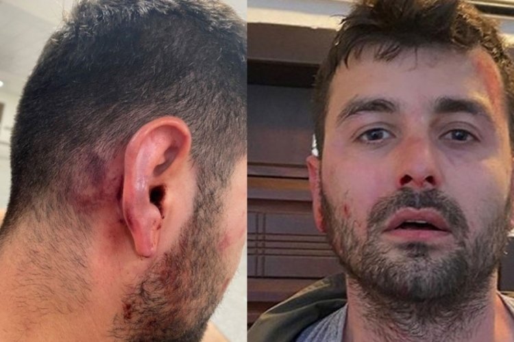 &Uuml;nl&uuml; futbolcunun kardeşi dehşet sa&ccedil;tı
