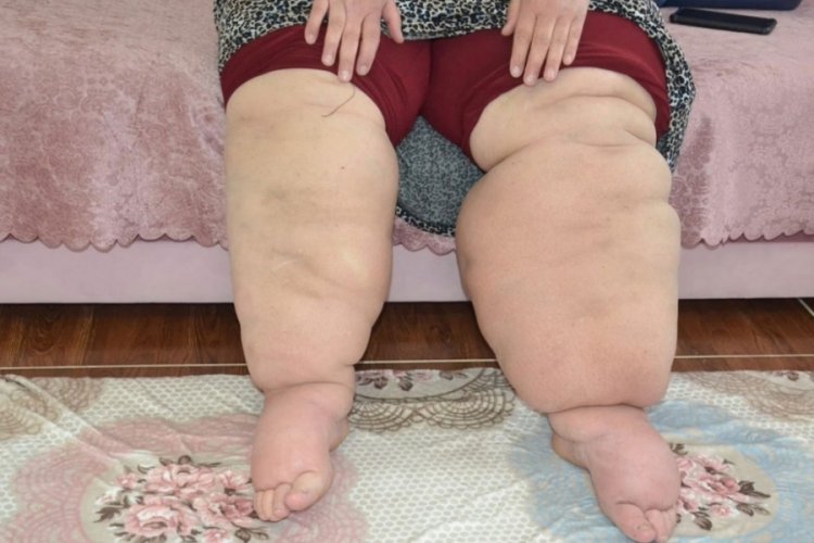 15 yıldır teşhis edilemeyen hastalığı ile kabusu yaşıyor