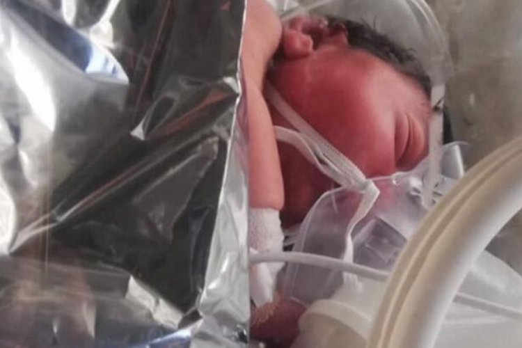 Hayati tehlikesi bulunan bebeğe polis helikopteriyle sevk edildi