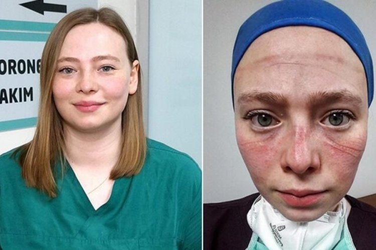 Seher hemşire: Maske kalktı ama izleri ve hatıraları hep bizimle