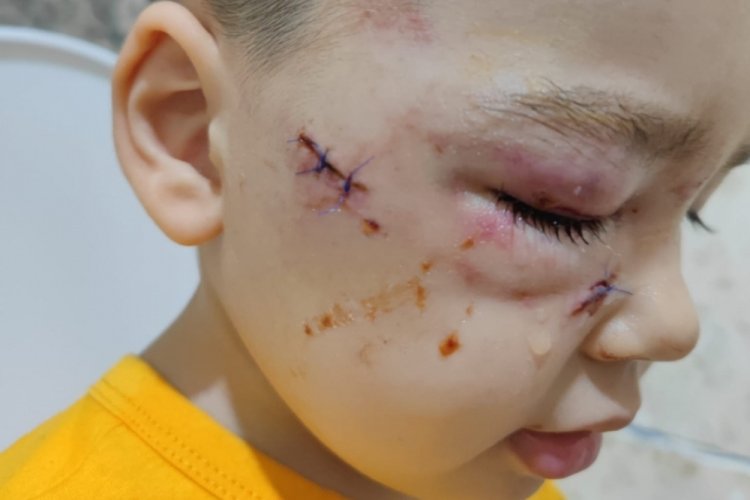 Adana'da k&ouml;peğin saldırısına&nbsp;uğradığı iddia edilen &ccedil;ocuğun babasından su&ccedil; duyurusu