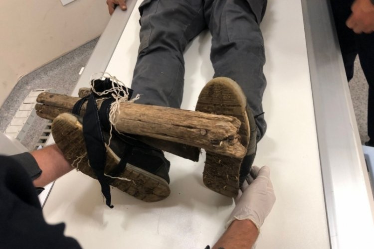 Ayağına batan &ccedil;ivili tahta ile hastaneye gitti