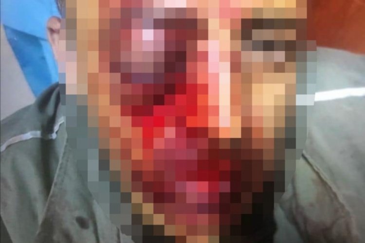 Orman muhafaza memurunu tekme tokat d&ouml;vd&uuml;ler
