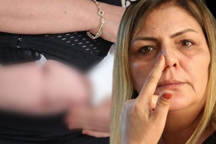Estetik olmak istedi hayatı karardı