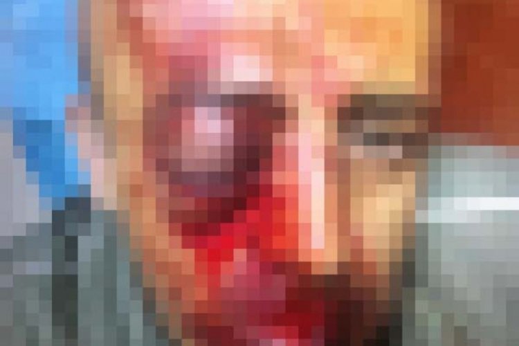 Osmaniye'de orman muhafaza memurunu d&ouml;ven ş&uuml;pheliler serbest