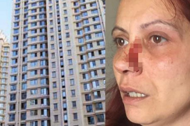 İstanbul'da aidat vermediği gerek&ccedil;esiyle kadını darbettiler