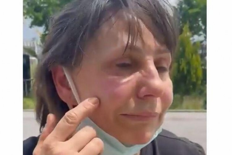 Sokak k&ouml;peklerini beslerken saldırıya uğradı