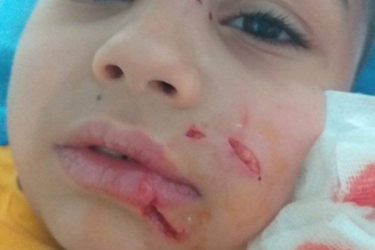 Minik Yiğit, başıboş k&ouml;peğin saldırısına uğradı