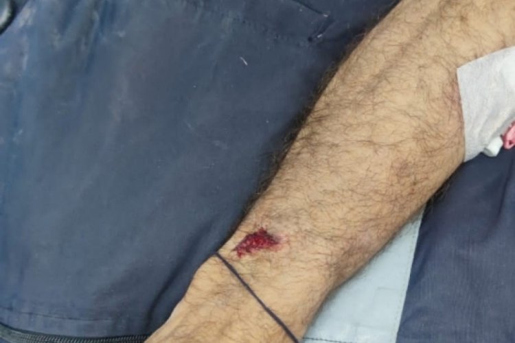 Sokak k&ouml;pekleri yaşlı adama saldırdı