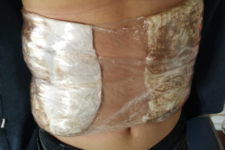 Bolu'da v&uuml;cuduna sardığı 940 gram esrarla yakalandı