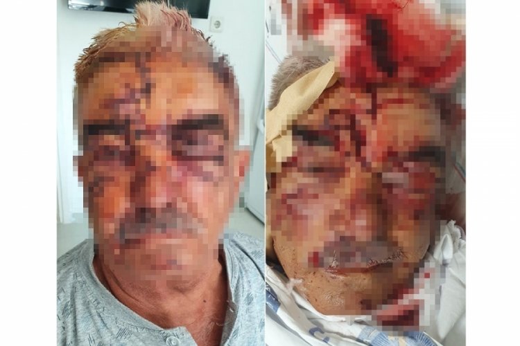 Komşusunun beslediği k&ouml;peğinin saldırısına uğradı