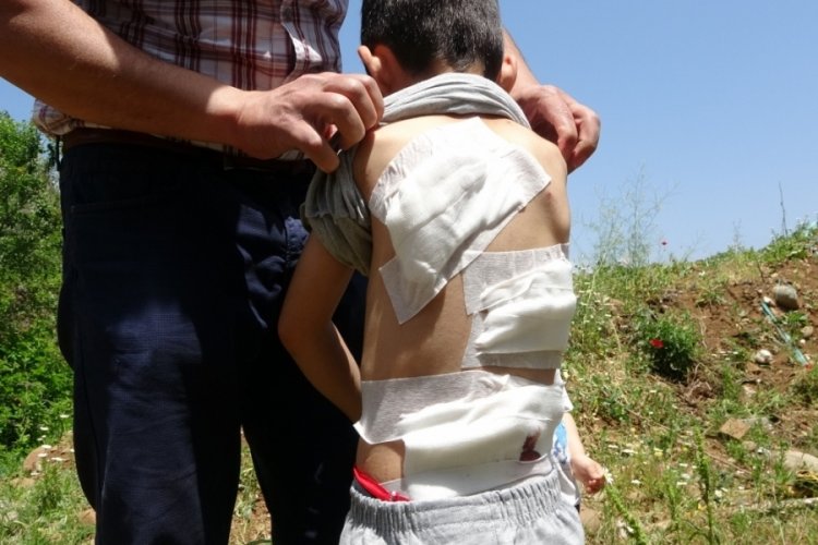 6 yaşındaki Osman erik toplarken k&ouml;peklerin saldırısına uğradı