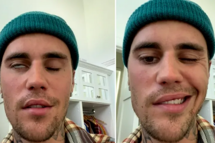 Justin Bieber, kısmi y&uuml;z felci ge&ccedil;irdi