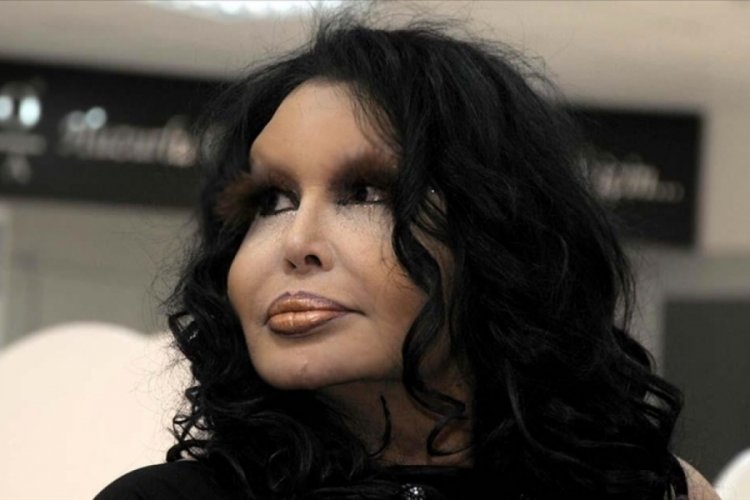 Diva &ccedil;ileden &ccedil;ıktı: &Ouml;lmedim arkadaşlar