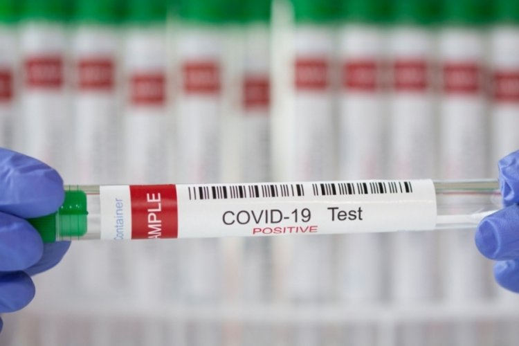 Almanya'da Kovid-19 testleri 3 eurodan satılacak