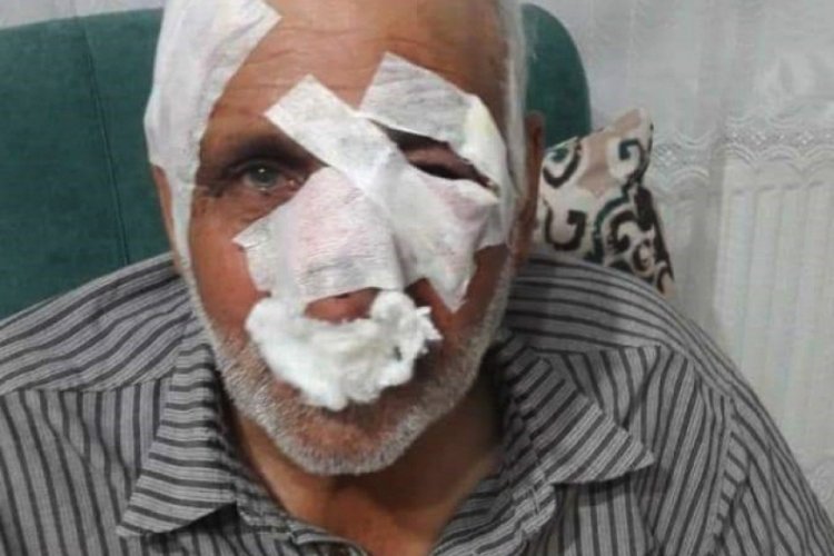 Gaziantep'te k&ouml;pek saldırısına uğrayan Mustafa Topal yaşam savaşında yenildi