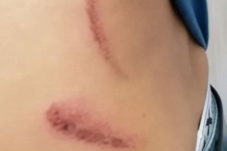 Manisa'da yol verme kavgası: 1'i ağır 4 yaralı