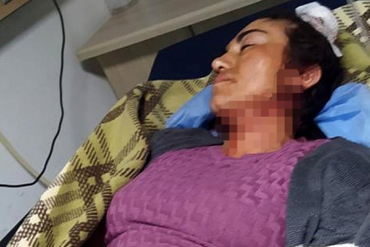 Husumetlileri tarafından saldırıya uğrayan &ccedil;ift, yaralandı