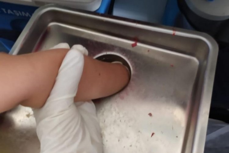 Elini kıyma &ccedil;ekme makinesine kaptıran 4 yaşındaki &ccedil;ocuk yaralandı