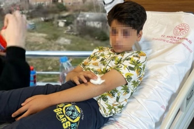 Adana'da bir &ccedil;ocuk 'Ses bombası yapımı' video izleyip evde denedi