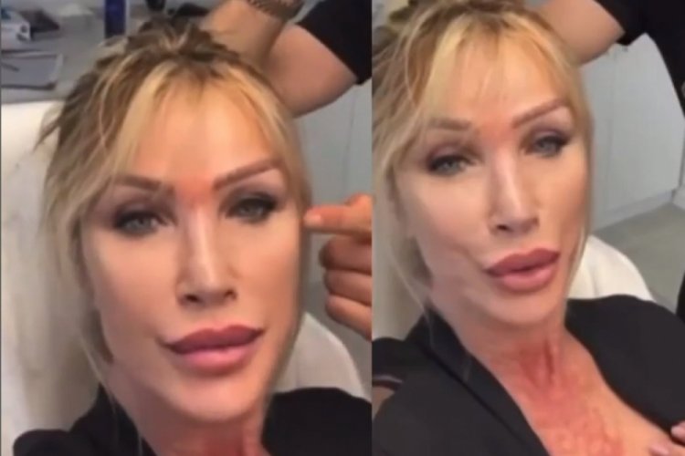 Seda Sayan yine estetik yaptırdı