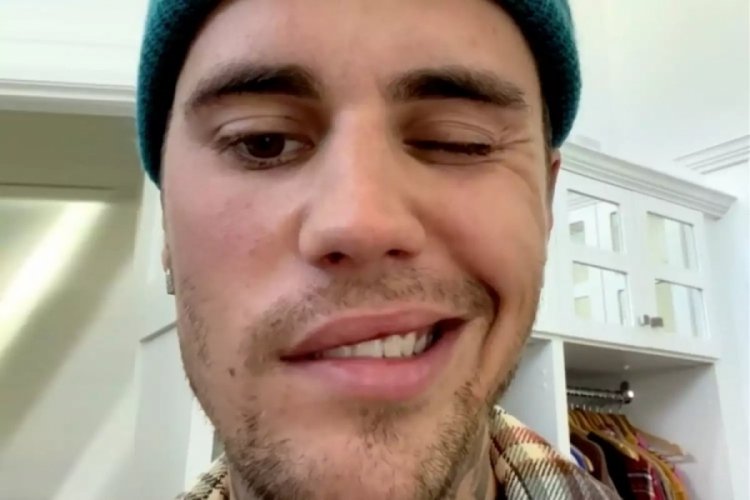 Y&uuml;z felci ge&ccedil;iren Justin Bieber, turuna kaldığı yerden devam edecek