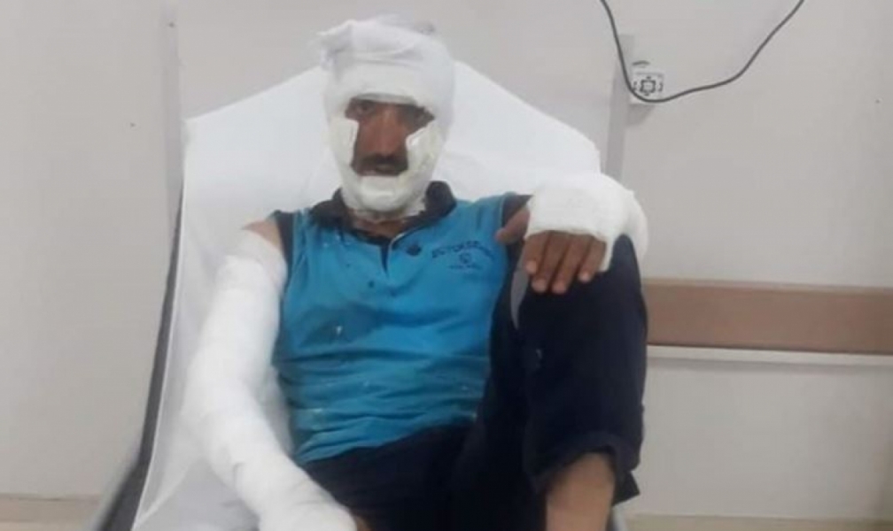 R&ouml;gar kapağında patlama: 2 iş&ccedil;i yaralı