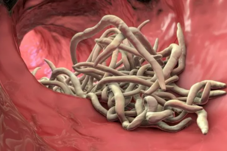 Kanserle savaşta 'solucan' umudu!
