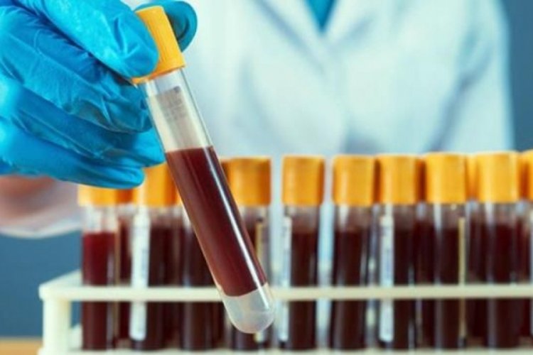 Uzmanlar Hepatit B vir&uuml;s&uuml;ne karşı uyardı
