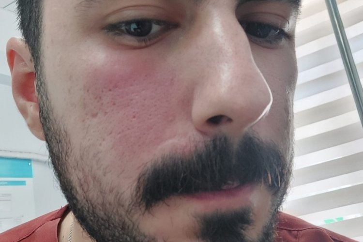 Hasta yakını sağlık &ccedil;alışanlarını darbettiği iddiasıyla g&ouml;zaltına alındı