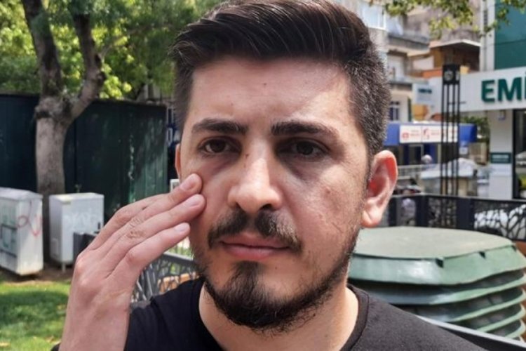 Hemşirenin burnunu kırdı serbest bırakıldı