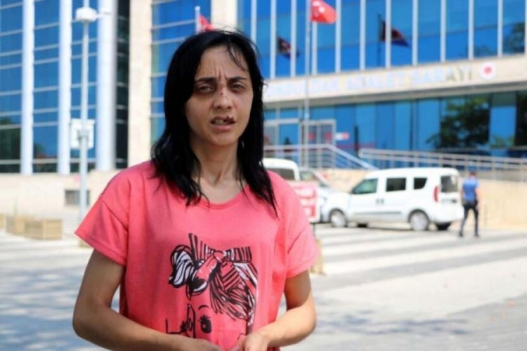 Sokakta tanımadığı kadına yumruk attı