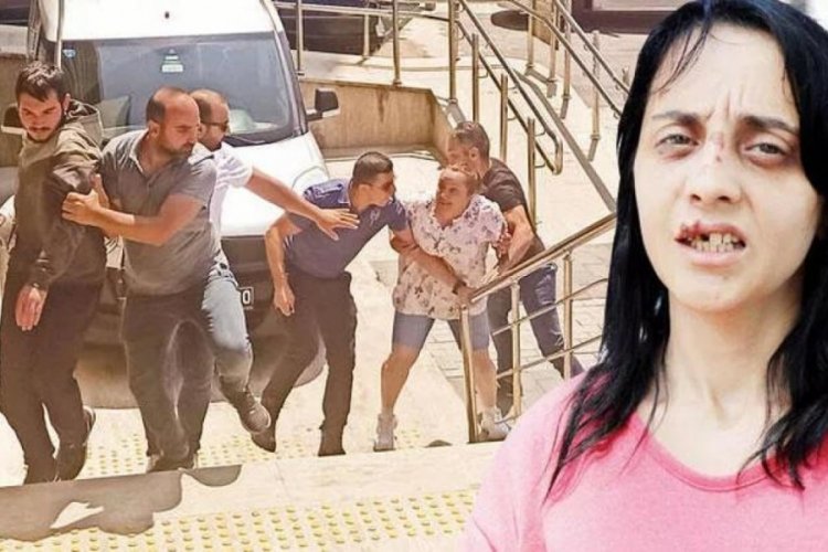 Hi&ccedil; tanımadığı kadının dişlerini kıran şahsın ifadesi şaşırttı
