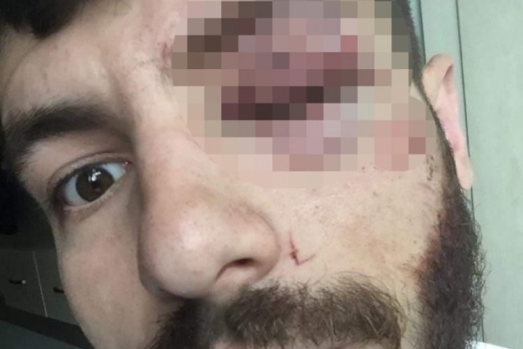İstanbul'da sigortasız &ccedil;alıştırılan iş&ccedil;i, hakkını isteyince saldırıya uğradı
