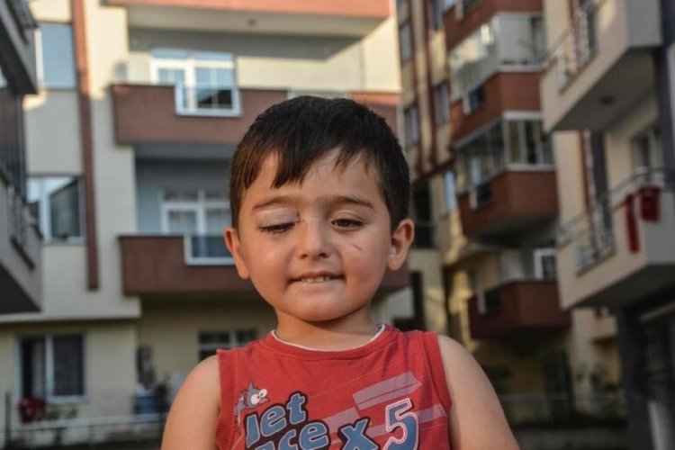 3 Yaşındaki &ccedil;ocuk k&ouml;peklerin saldırısında yaralandı