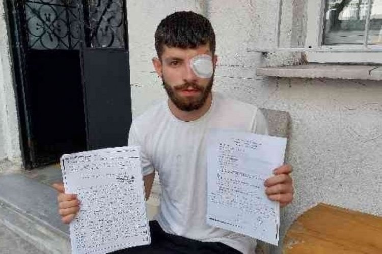Muhasebeci iş&ccedil;inin g&ouml;z&uuml;ne bardak attı
