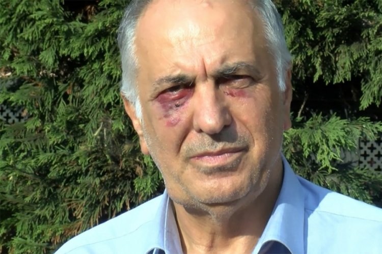 Alevi Vakıfları Federasyonu İkinci Başkanına saldırıda flaş gelişme