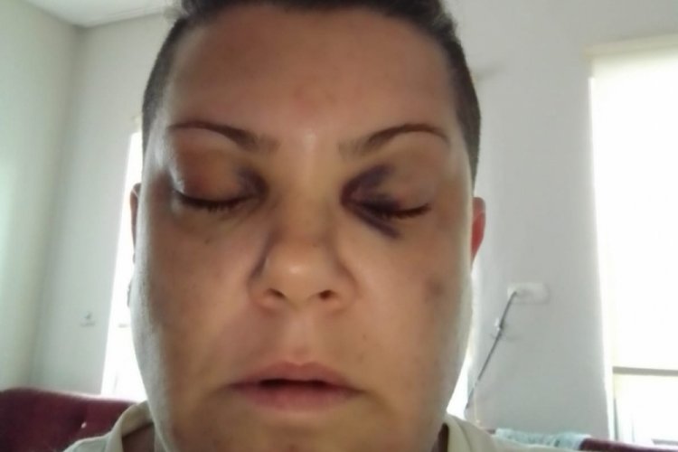 Şarkıcı Mevlanaoğlu, evinin &ouml;n&uuml;nde d&ouml;v&uuml;ld&uuml;